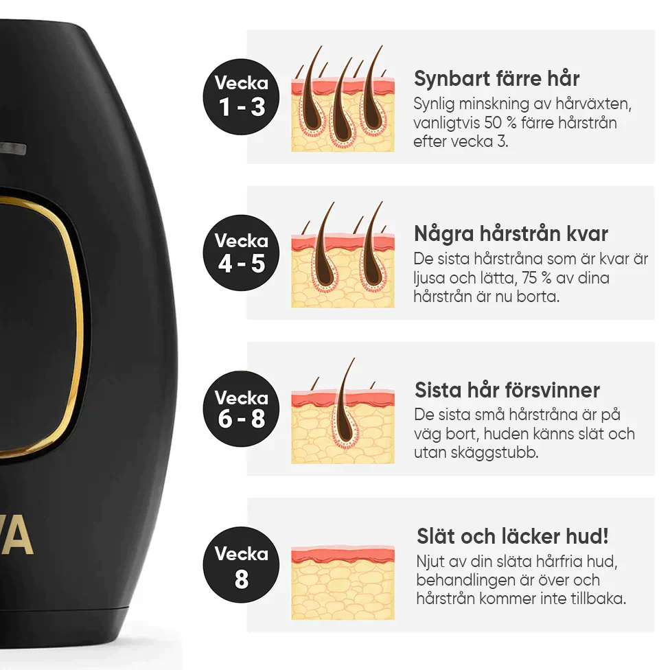 IPL - trajno uklanjanje dlaka