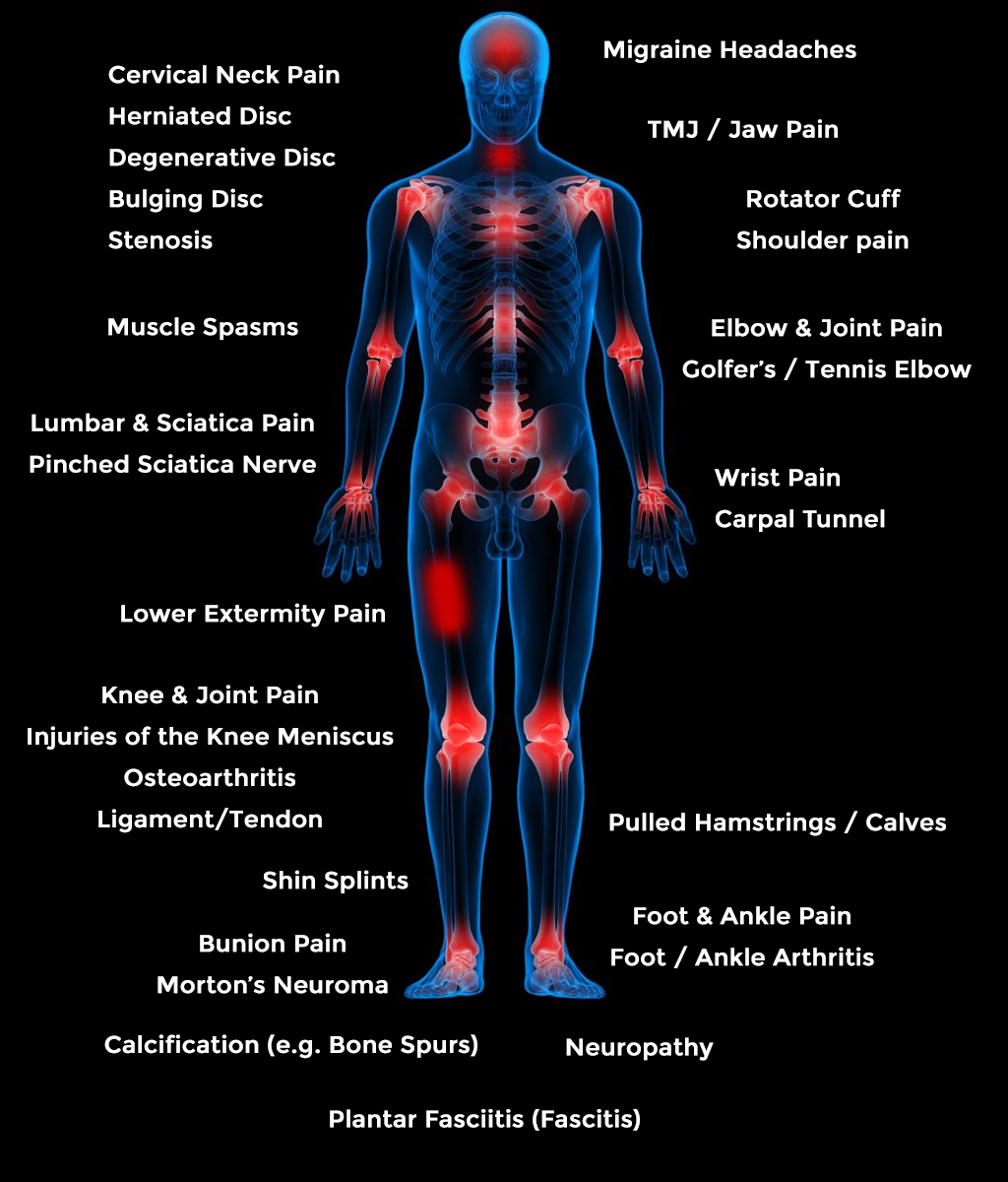 Dispositivo di terapia a luce rossa laser fredda migliorato LumaPulse