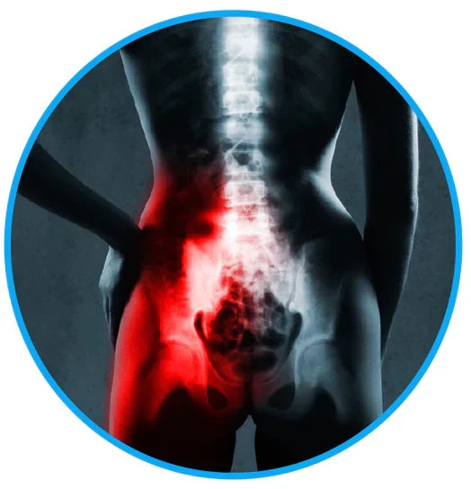 חגורת הקלה על כאבי סיאטיקה - סלק את כאבי הסיאטיקה וכאבי הגב התחתון שלך