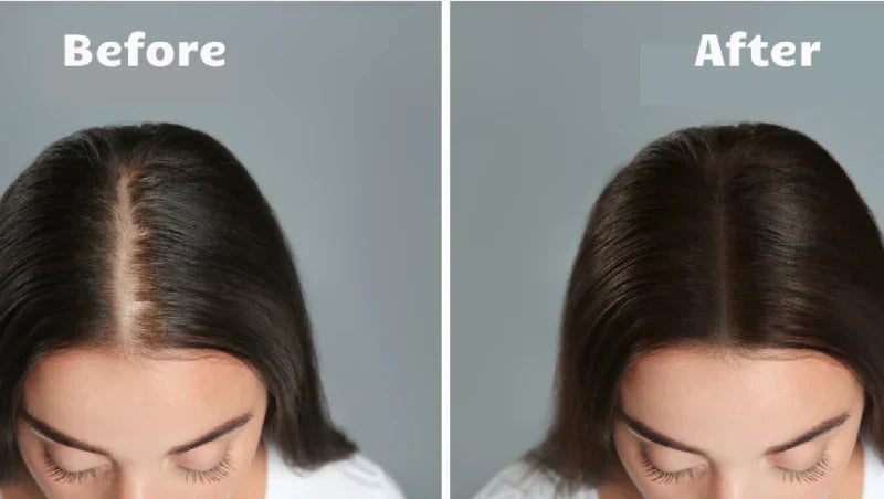 Thérapie lumineuse RadiantGlow pour des cheveux plus épais, plus fournis et plus sains en 10 minutes par jour
