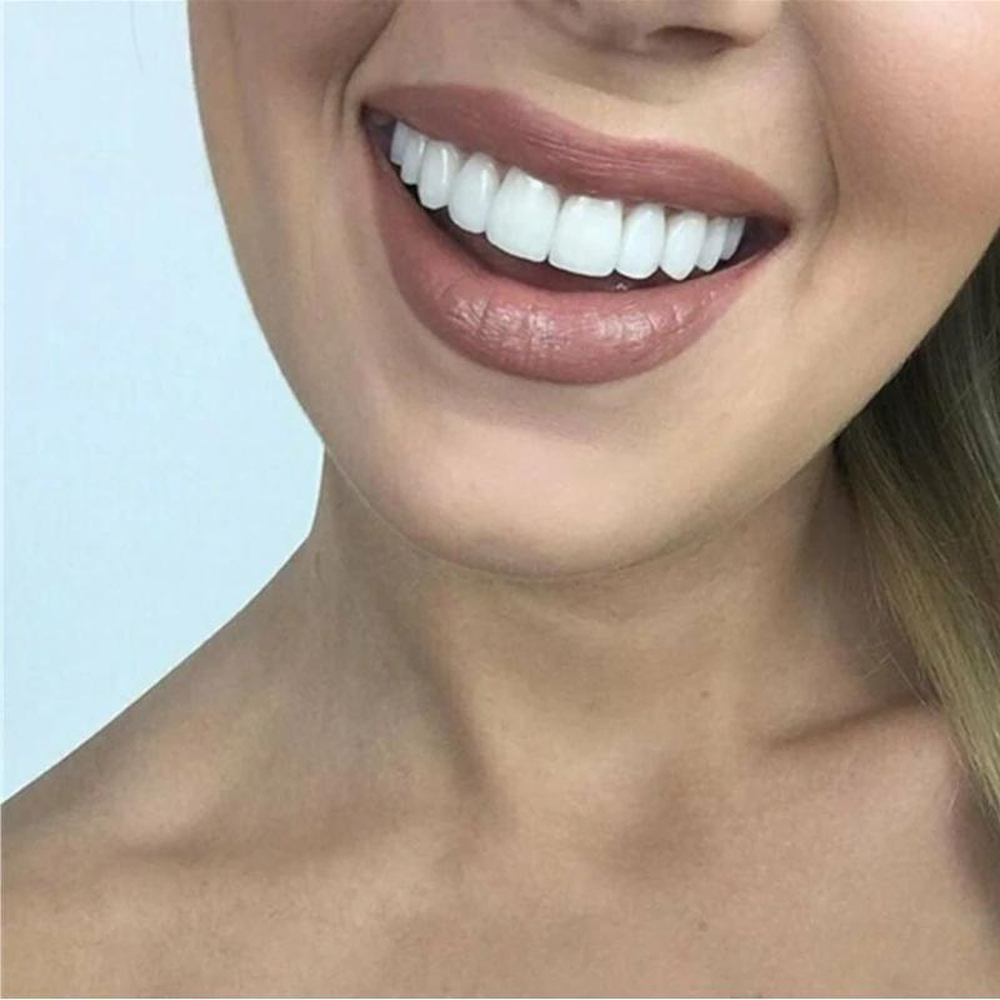 Solution NovaBright pour la réparation des dents et un sourire parfait