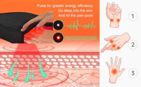 Gants de thérapie par lumière rouge pour l'arthrite, soulagement de la douleur du poignet et de la main, proche infrarouge